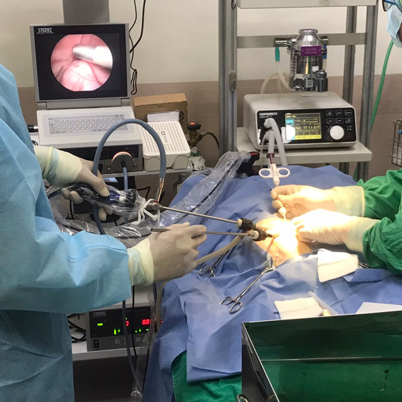 內視鏡微創治療