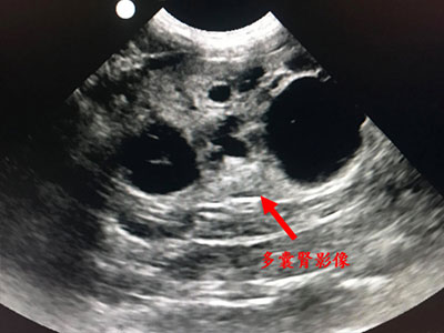 可怕的先天性腎臟病-貓的多囊腎