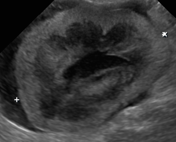 貓咪腎臟病 腎臟腫瘤 貓淋巴癌化療