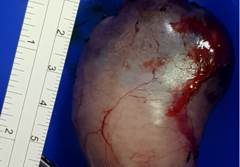 肚子裡的不定時炸彈-狗狗的膽囊黏液囊腫