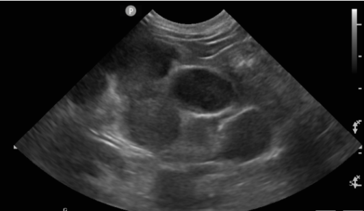 貓 淋巴癌 胸水 胸腔前縱膈腔腫瘤 腹腔淋巴結腫大 化療 不是感冒