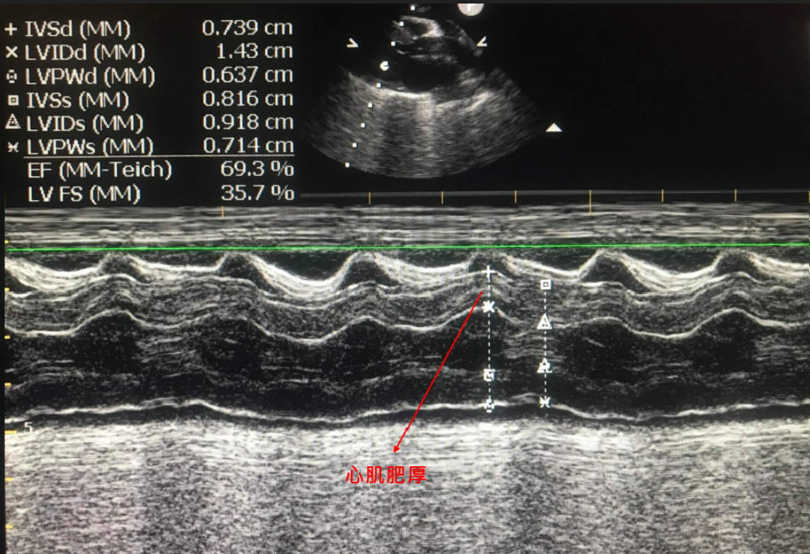 淺談貓心臟超音波快速掃描(QUICK SCAN) 的意義    貓咪心臟病 貓心臟超音波檢查