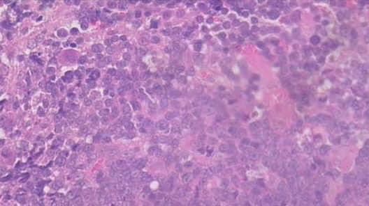 貓白血病及淋巴瘤