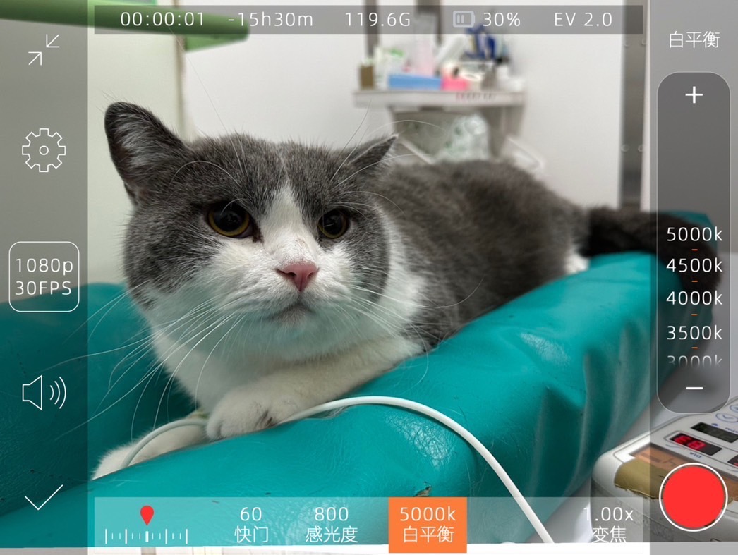 肥厚性心肌病 心衰竭肺積水