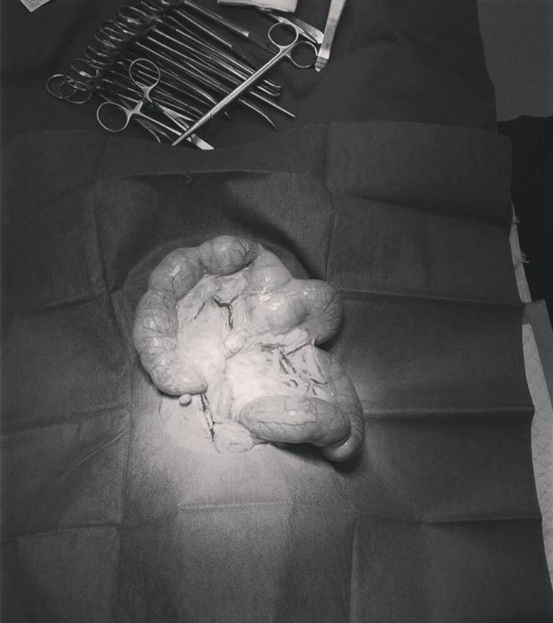 子宮蓄膿的狗狗 股骨頭脫位 尿道結石 胃扭轉(GDV) 急性腎損傷