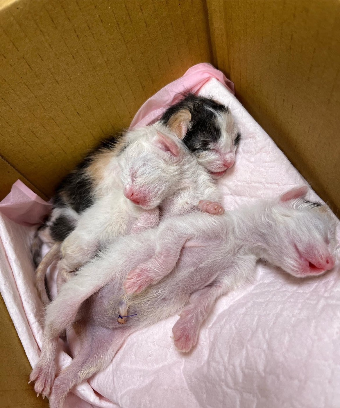 剖腹產喜獲三千金