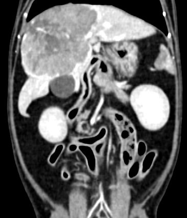 築心電腦斷層影像診斷 簡介 2